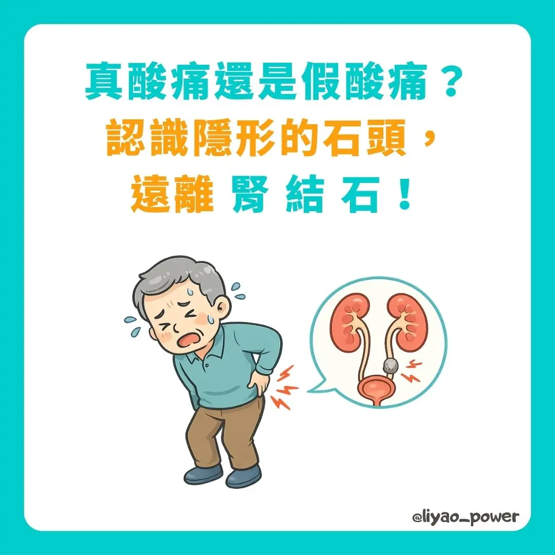 腎結石衛教封面