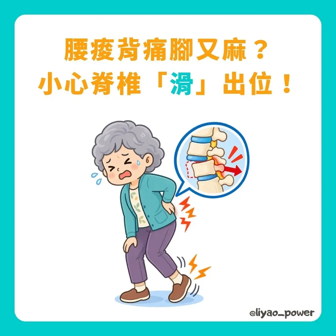 脊椎滑脫封面 