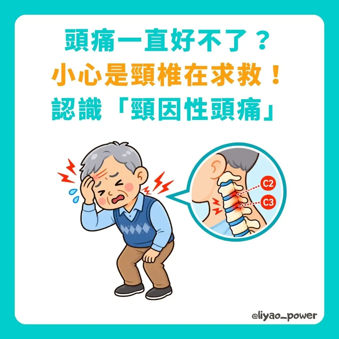 頸因性頭痛 封面